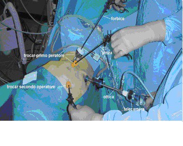 laparoscopia-rene.jpg